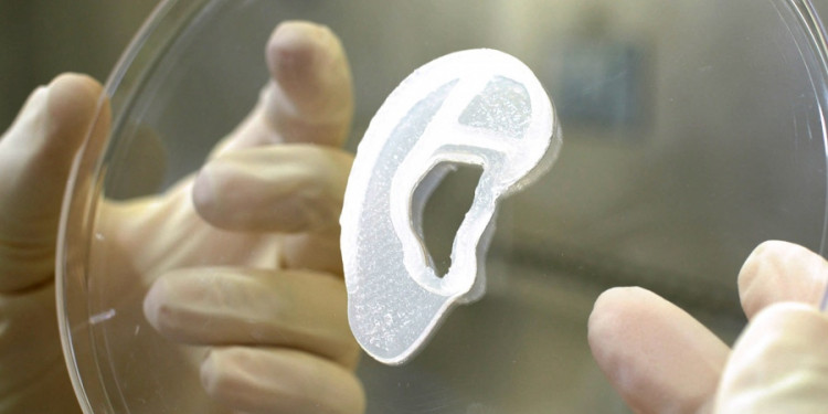 Trasplantan por primera vez una oreja impresa en 3D con células humanas