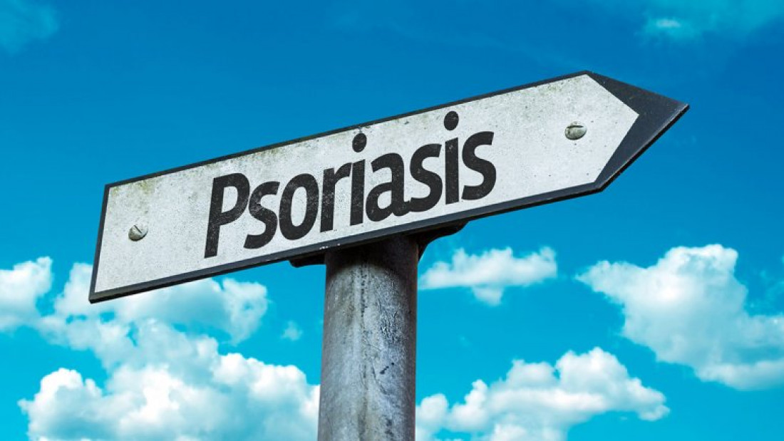 29 de octubre, "Día Mundial de la Psoriasis"