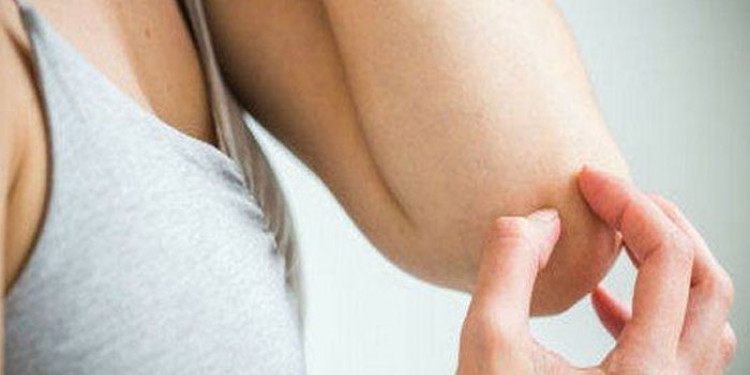 Día Mundial de la Psoriasis: una enfermedad del sistema inmune