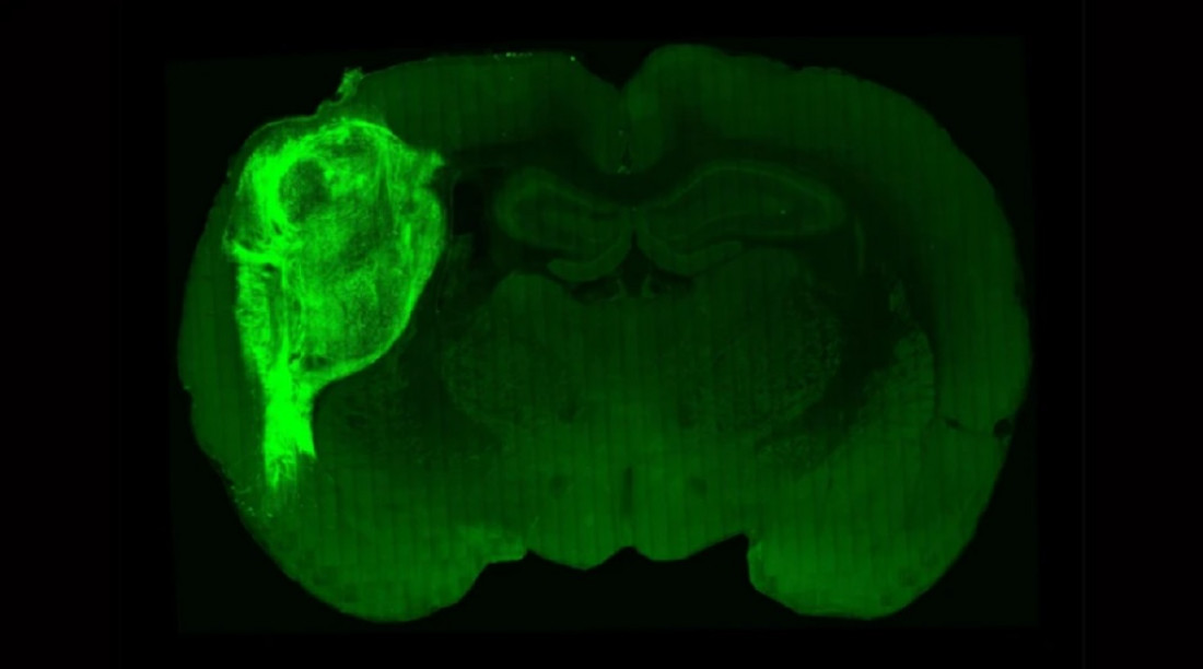 Científicos instalaron células cerebrales en ratas para estudiar los trastornos psiquiátricos