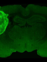 Científicos instalaron células cerebrales en ratas para estudiar los trastornos psiquiátricos