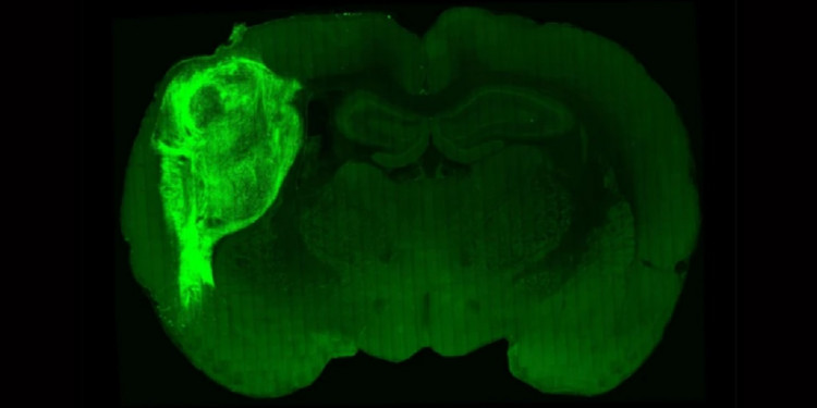 Científicos instalaron células cerebrales en ratas para estudiar los trastornos psiquiátricos