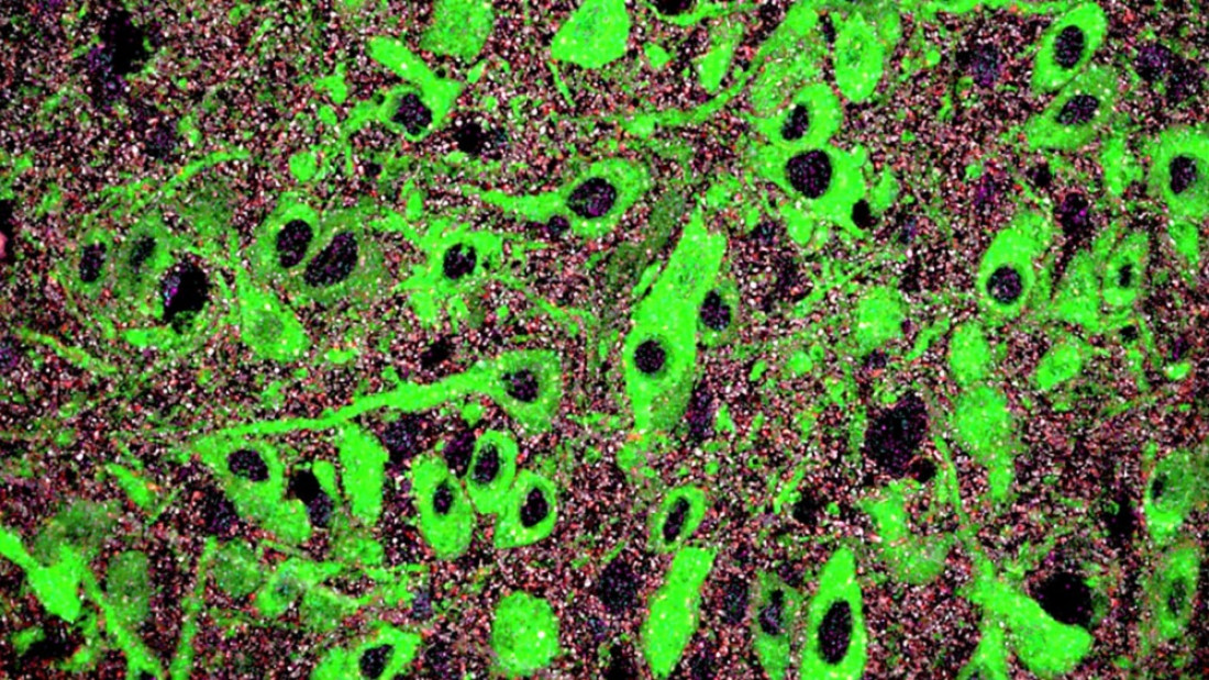 Identifican un mecanismo del neurodesarrollo cuya alteración contribuiría al origen de trastornos mentales