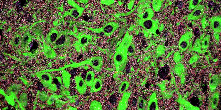 Identifican un mecanismo del neurodesarrollo cuya alteración contribuiría al origen de trastornos mentales