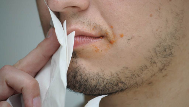 imagen ¿Por qué las servilletas de los bares y las pizzerías no limpian bien?