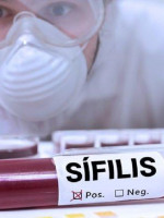 Aumentaron los casos de sífilis en América y hay más de 4,5 millones de personas infectadas 