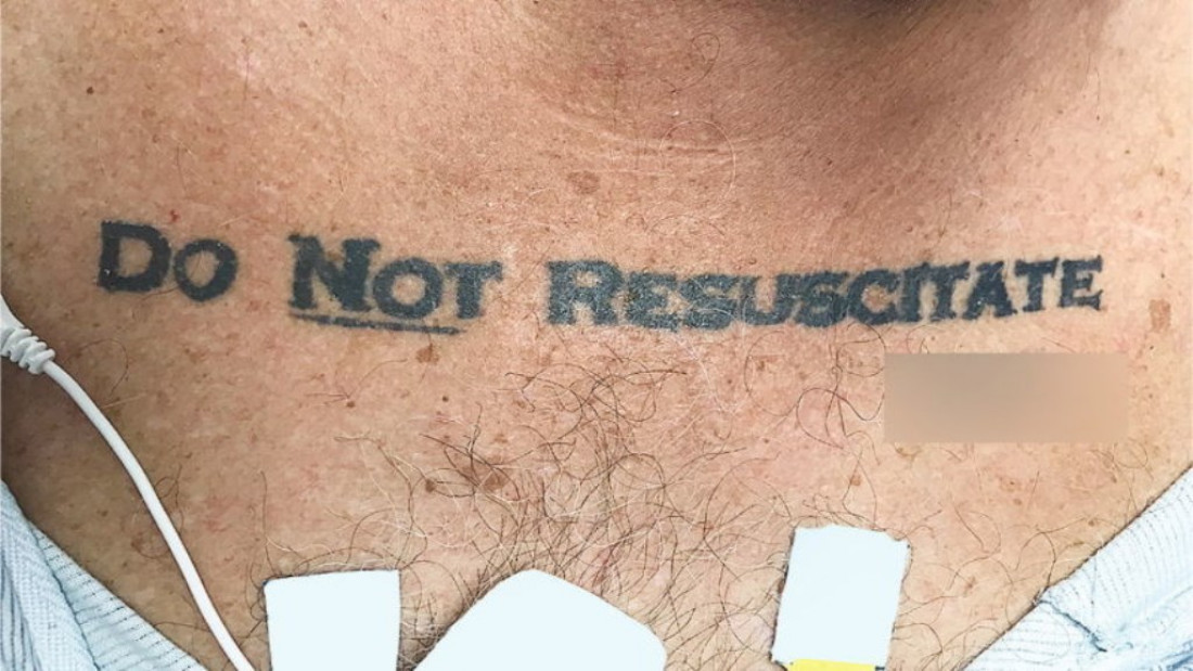 "No resucitar", el tatuaje que abrió el debate de vida o muerte