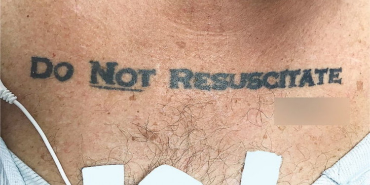 "No resucitar", el tatuaje que abrió el debate de vida o muerte