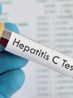 Salud detectó el primer caso de hepatitis aguda grave en el país