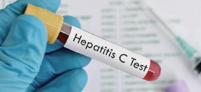 Salud detectó el primer caso de hepatitis aguda grave en el país