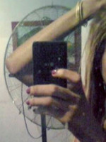 Una persona trans murió por un implante en los glúteos