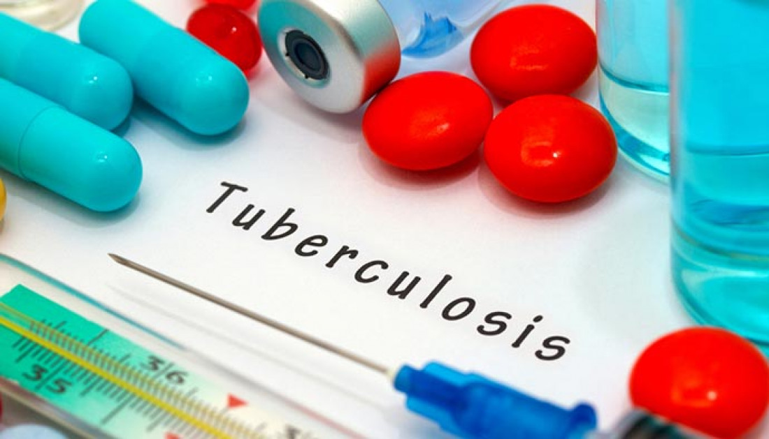 En Mendoza se dan 170 casos nuevos de tuberculosis por año