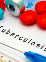 En Mendoza se dan 170 casos nuevos de tuberculosis por año