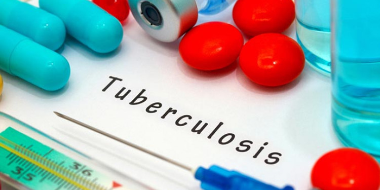 En Mendoza se dan 170 casos nuevos de tuberculosis por año