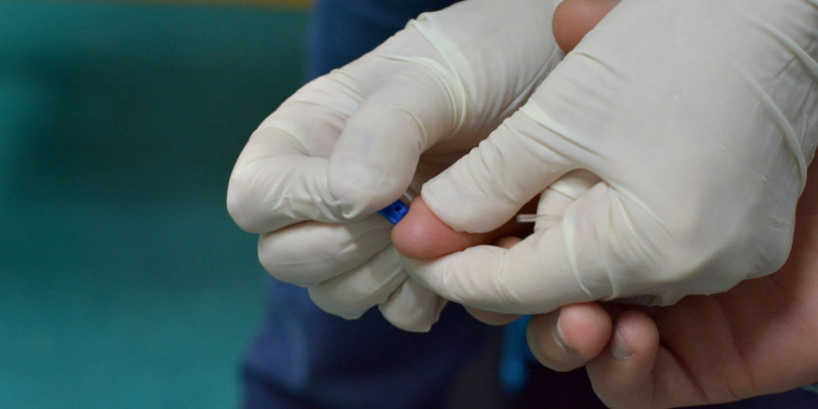 Comienzan los testeos de VIH y sífilis en la UNCUYO 