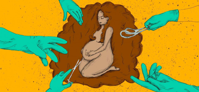 La epidemia de cesáreas "es una forma más de control del cuerpo de las mujeres" 