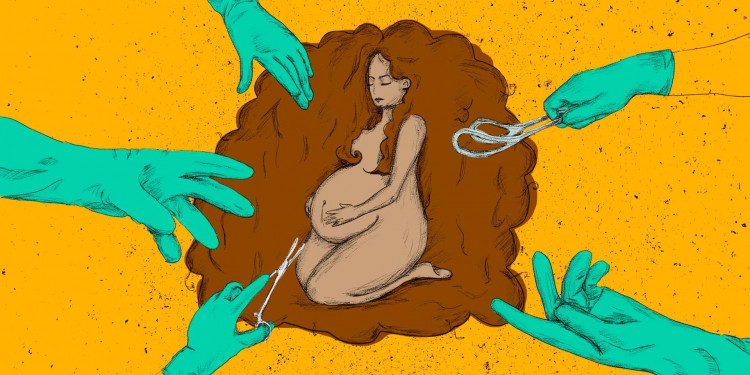 La epidemia de cesáreas "es una forma más de control del cuerpo de las mujeres" 