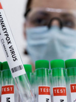 Confirmaron el quinto caso de viruela del mono en el país